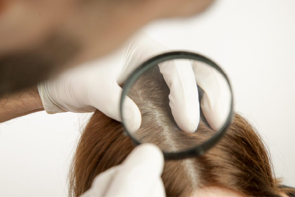 gloved hands parting hair while a magnifying glass focuses on the scalp